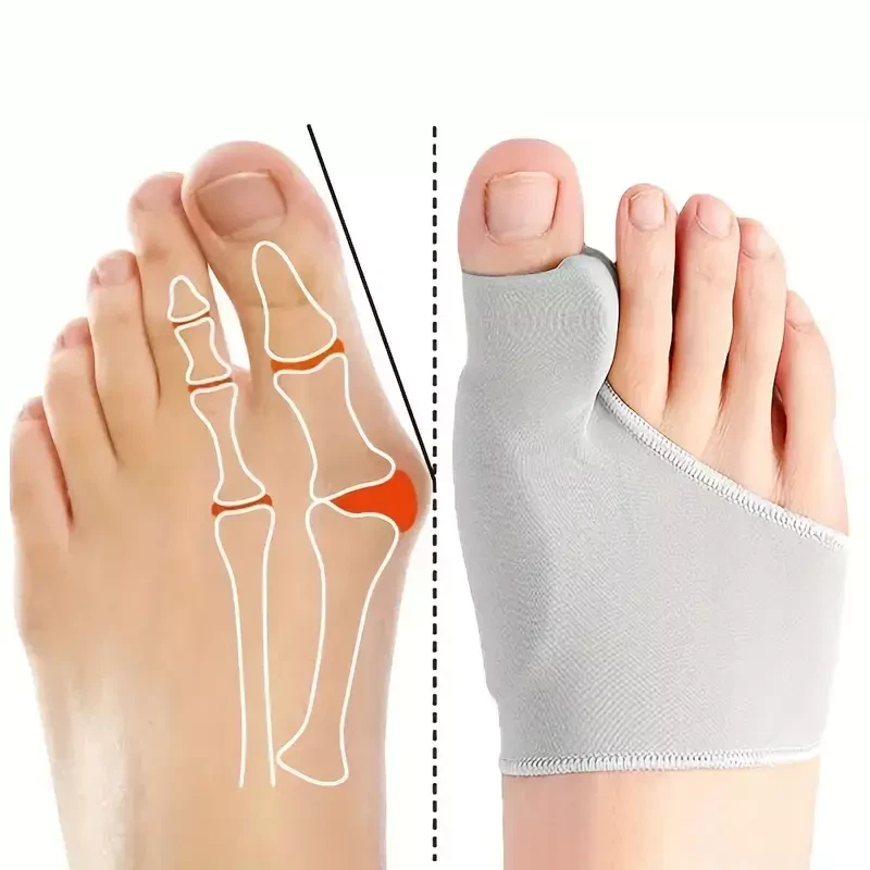 2Pack Bunion Corrector Hallux Valgus Corrector Straightener Foot Toe Separators